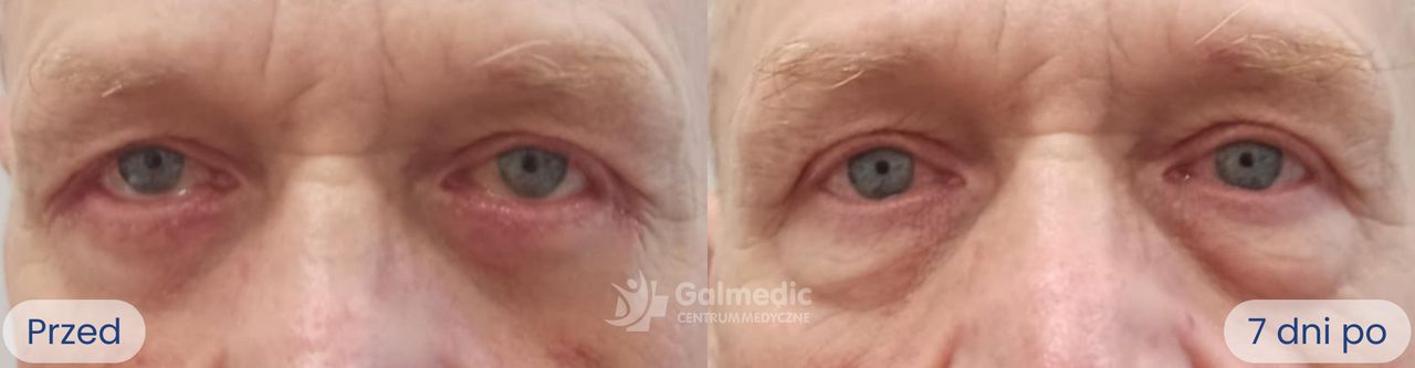 Aneta Michalik-Jakubek-5