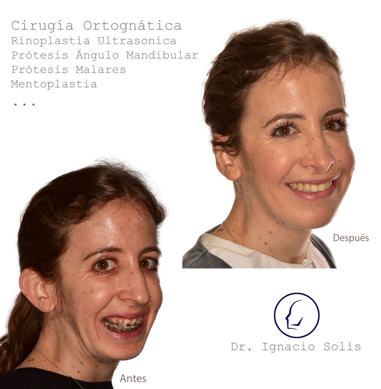 Ignacio Solís García-0