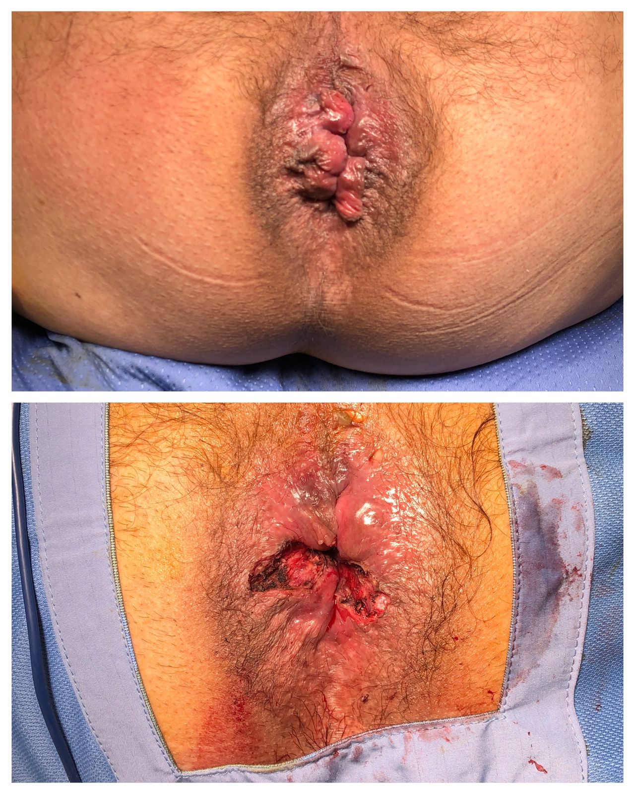 Antonio Ferronetti-5