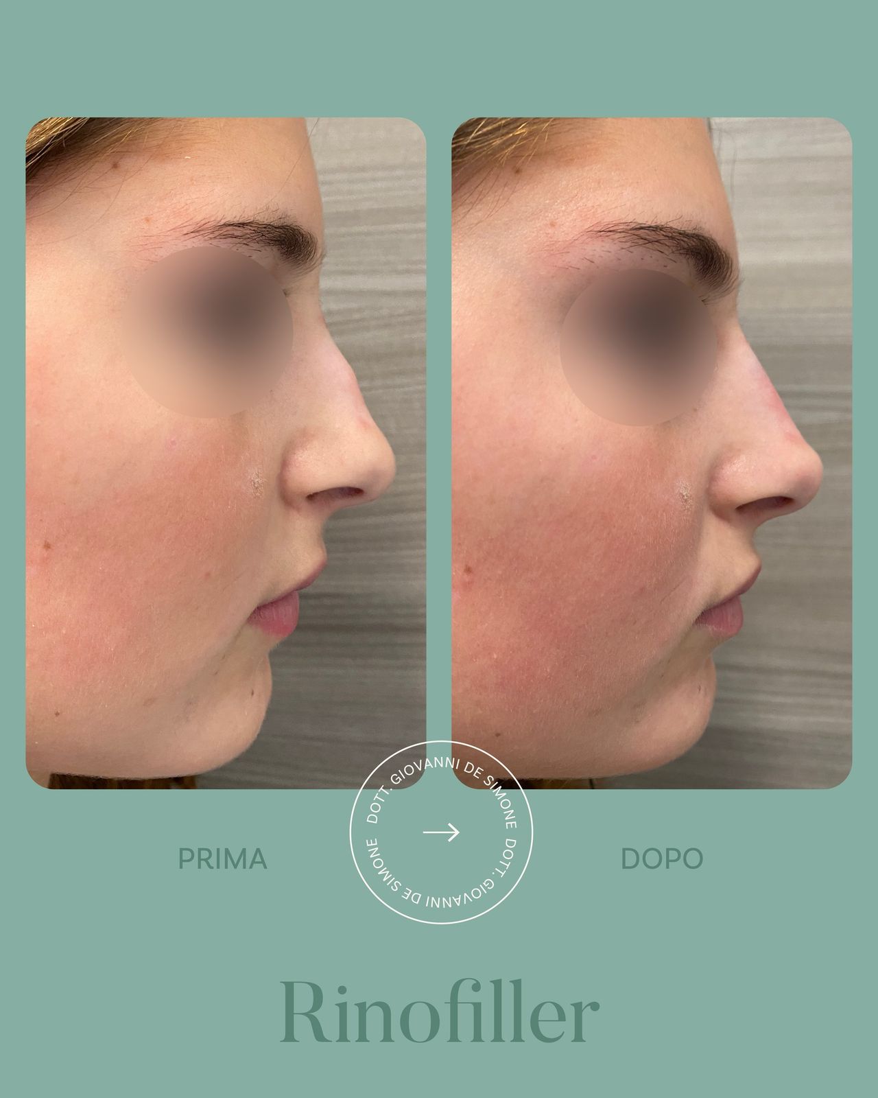 Giovanni De Simone-5