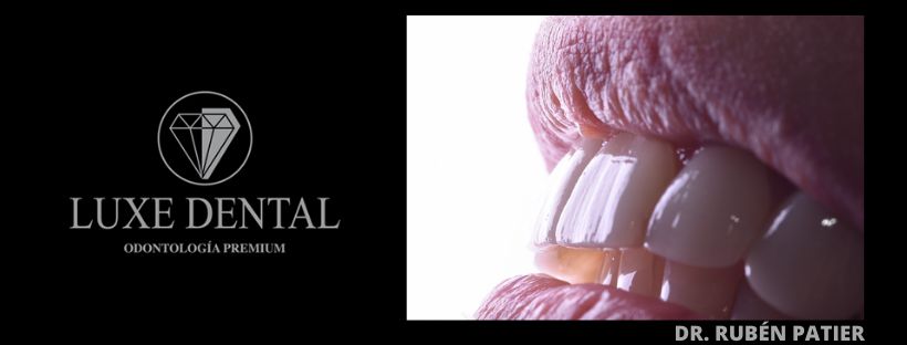 Ruben Patier Martin-24