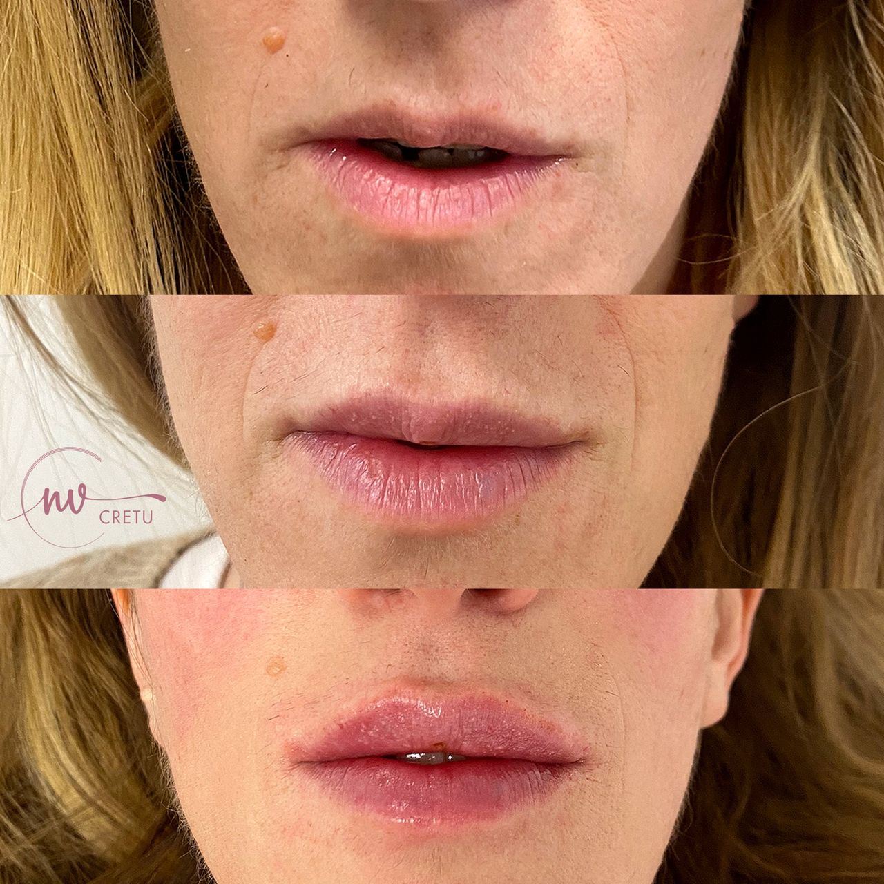 Noemi Virginia Cretu-6