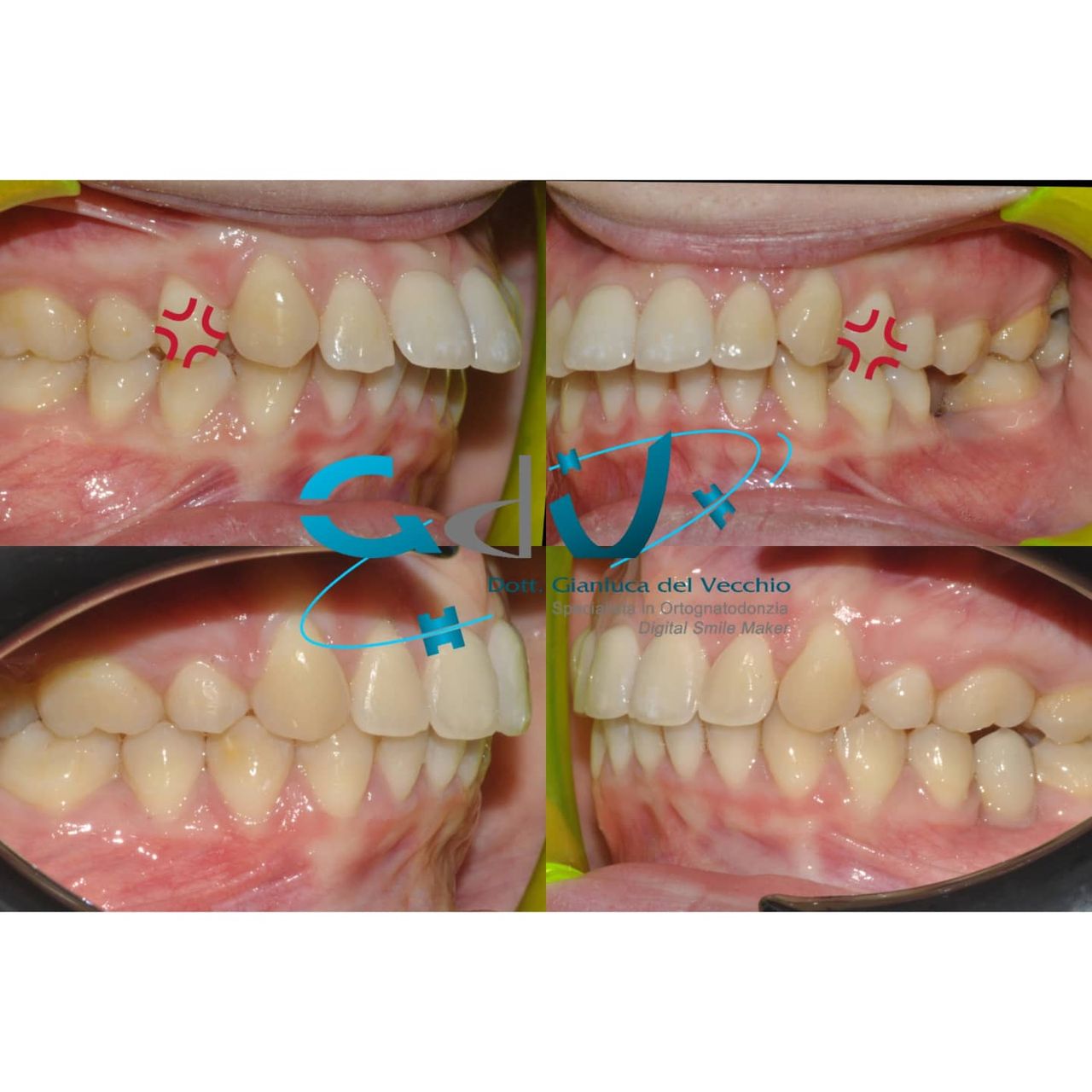 Gianluca Del Vecchio-169