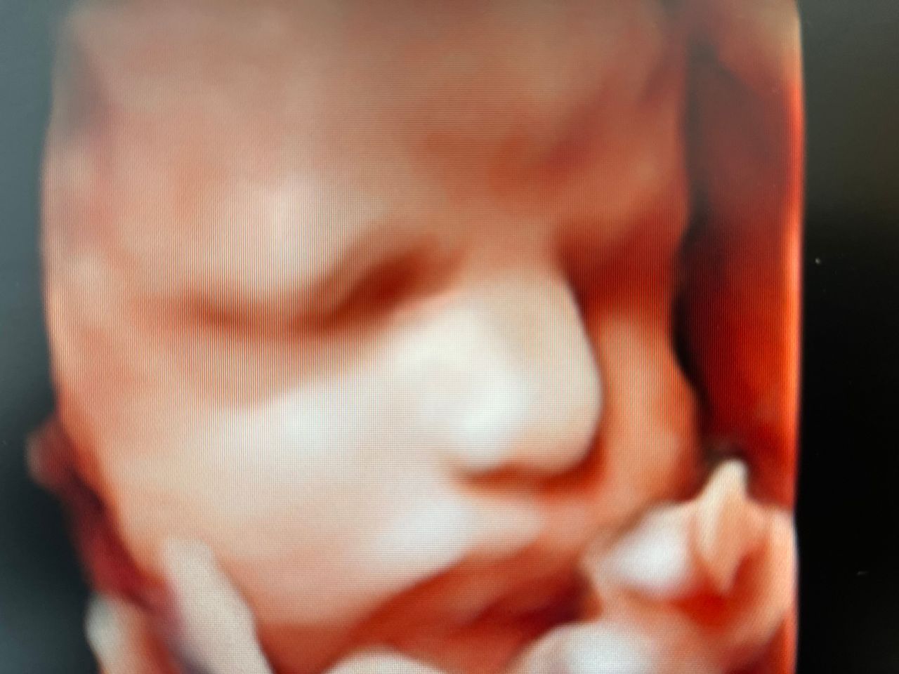 Jose Santiago-Cuadri Artacho-2