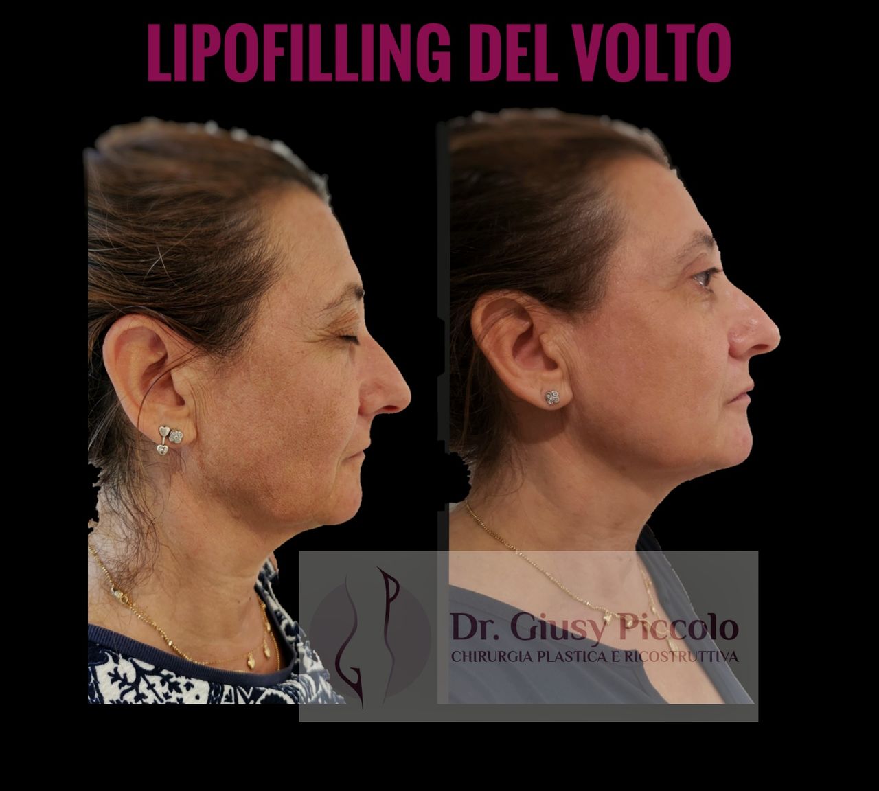 Giuseppina Piccolo-51