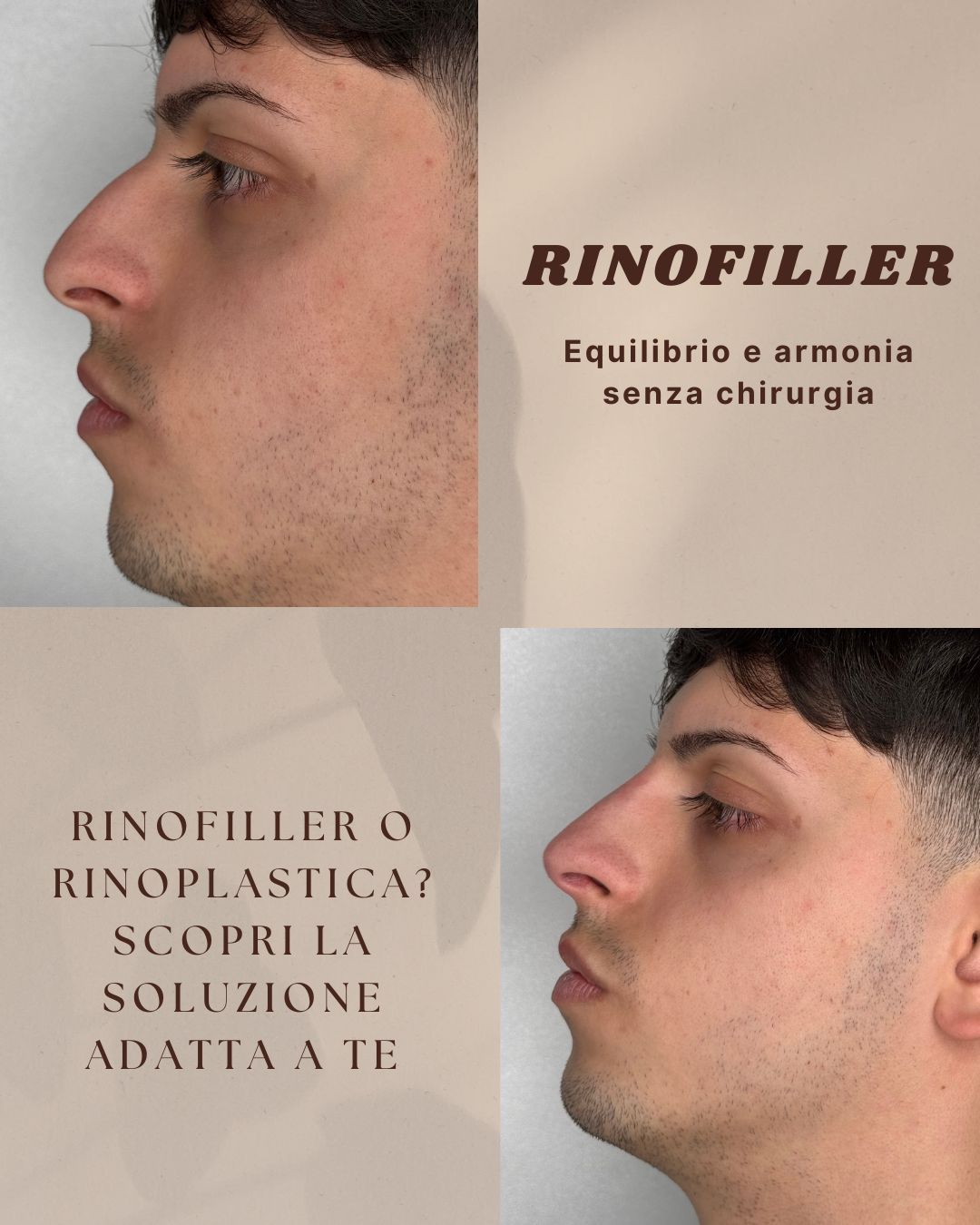 Federico Coppola-2