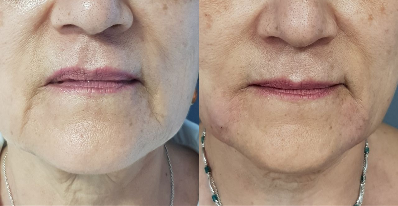 Rosalba Herrero Zerpa-65