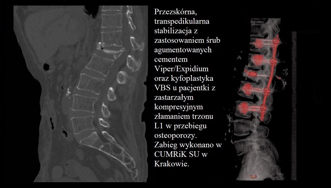 Daniel Płomiński-17