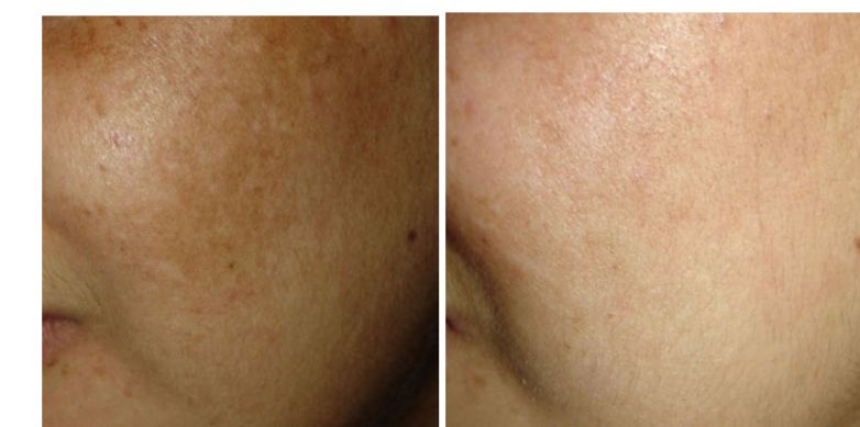 Elisabetta Fabiani-35