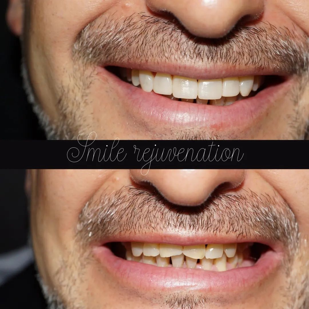 Raimonda Bogdanoviciute-21