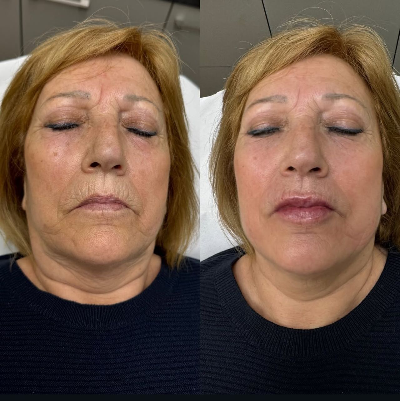 Andrea Catahysa Del Torto-9