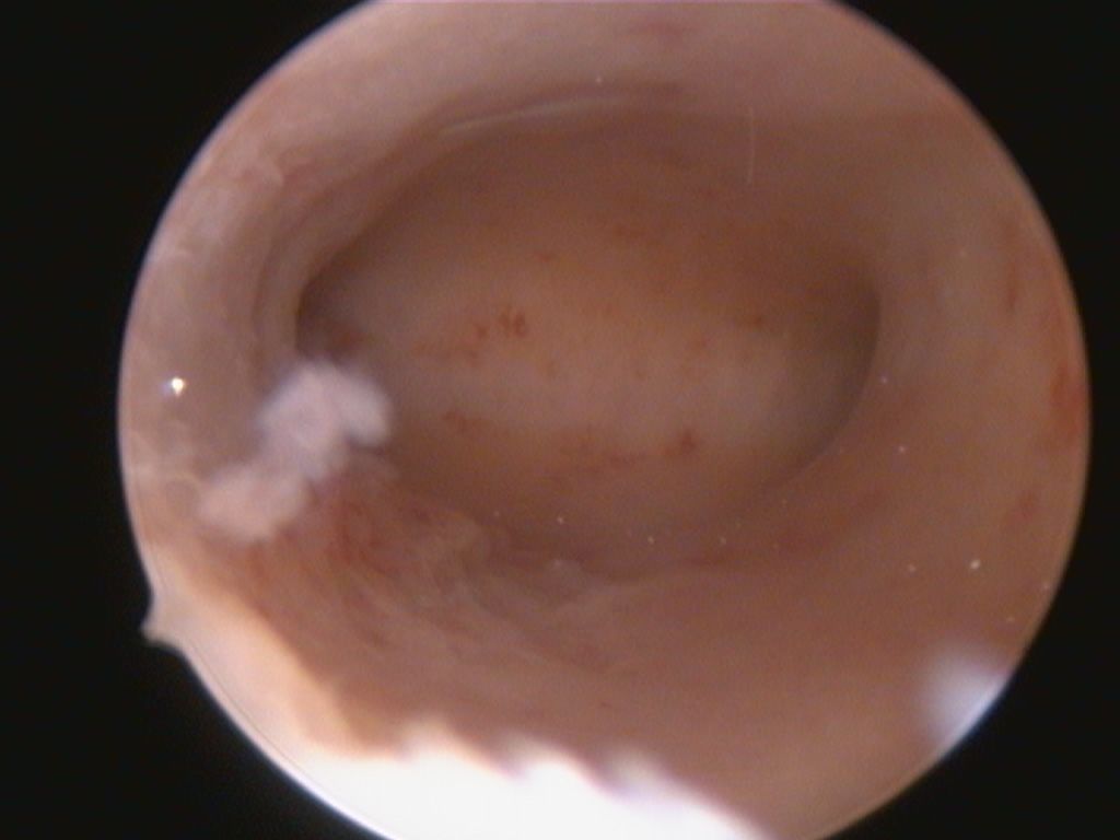 Francesco Paolo Improda-1