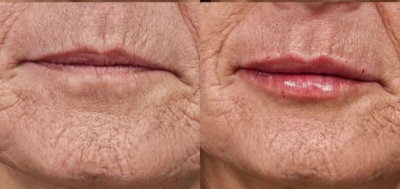 Rosalba Herrero Zerpa-572