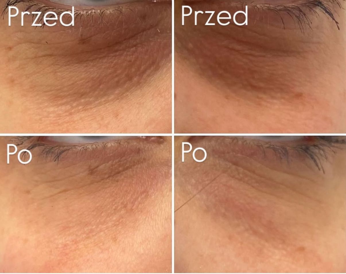 Aleksandra Kowalczuk-18