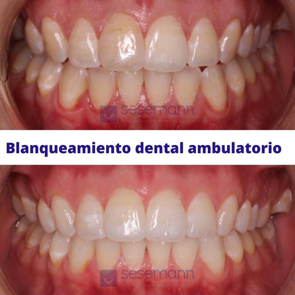 Paula Cano Carrillo-66