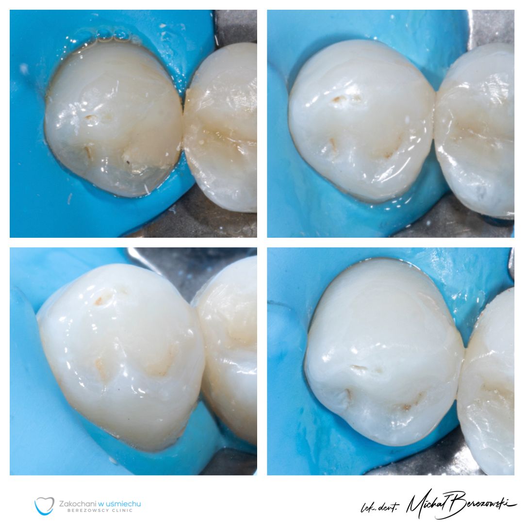 Michał Berezowski-46