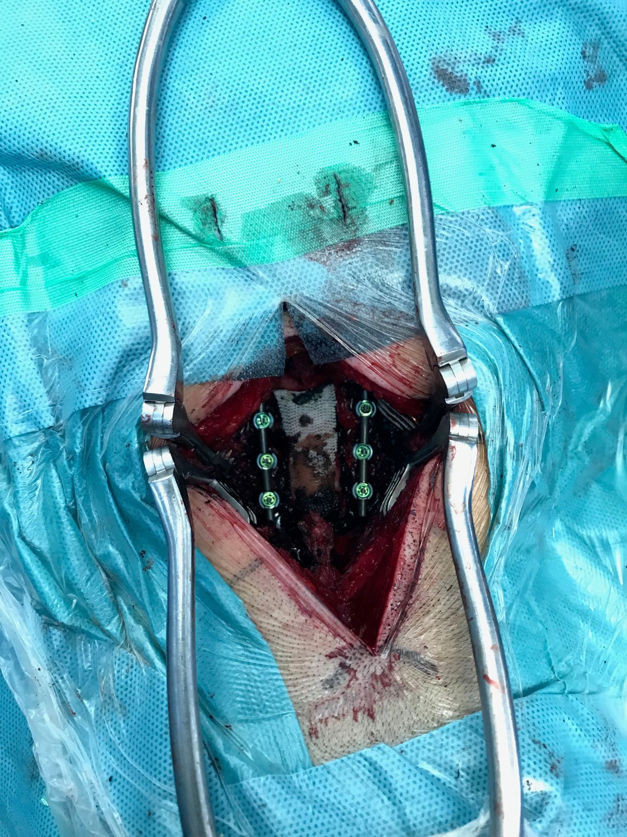 Juan Camilo Hernandez Acevedo-36