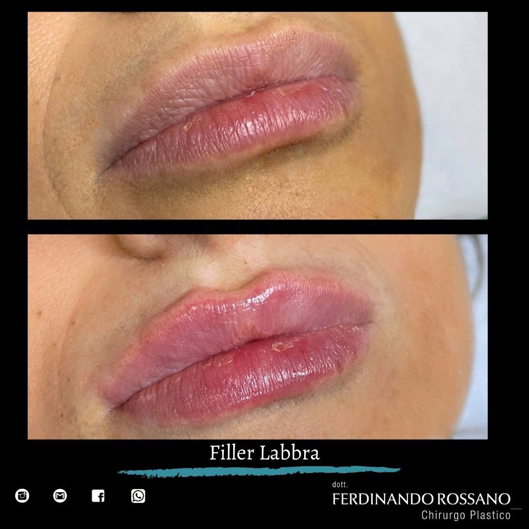 Ferdinando Rossano-5