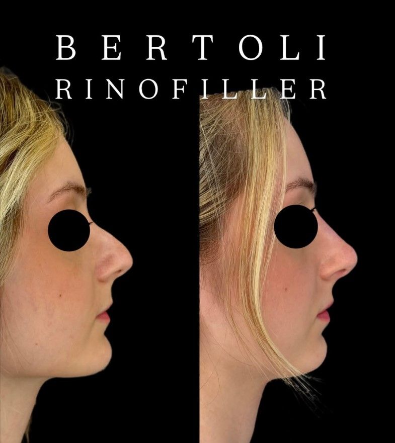 Andrea Bertoli-29