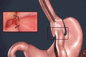 Jose Francisco Juanmartiñena-10