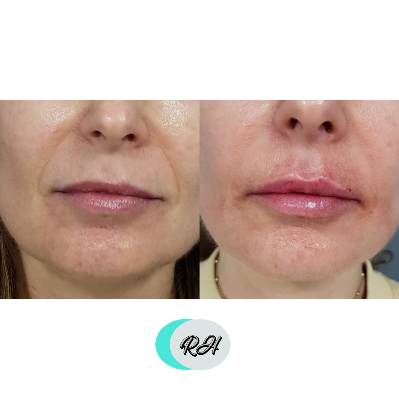 Rosalba Herrero Zerpa-138