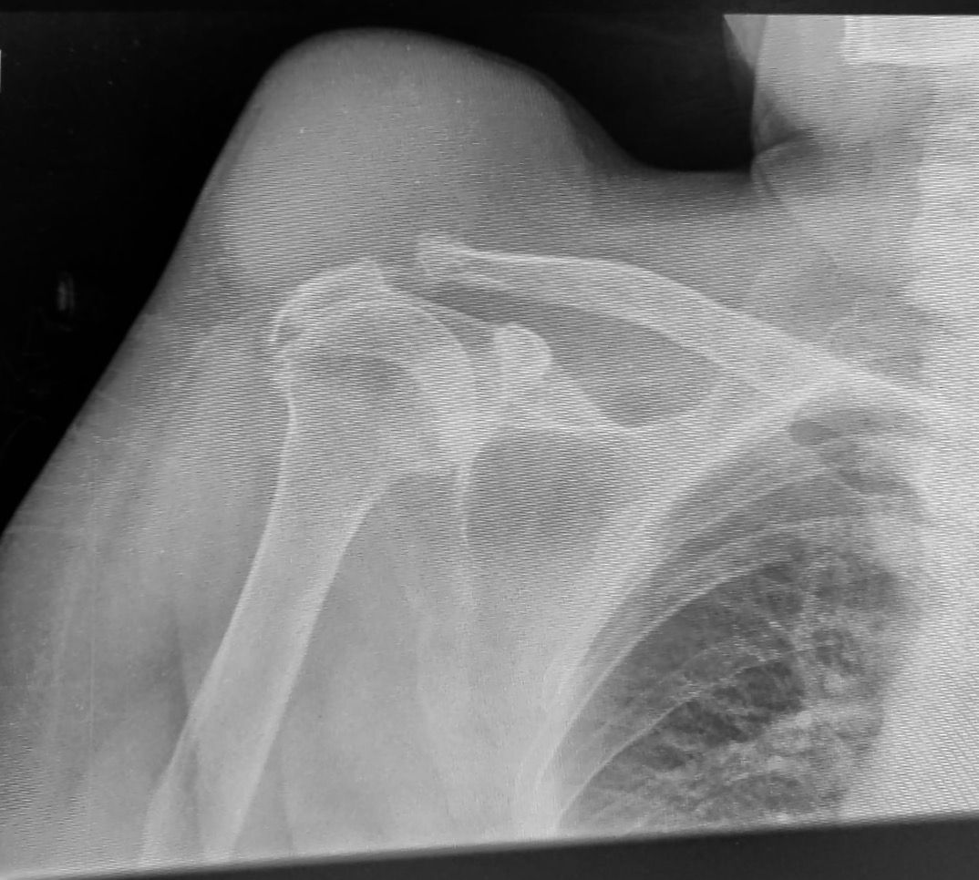 Eulogio Benito Martín-22