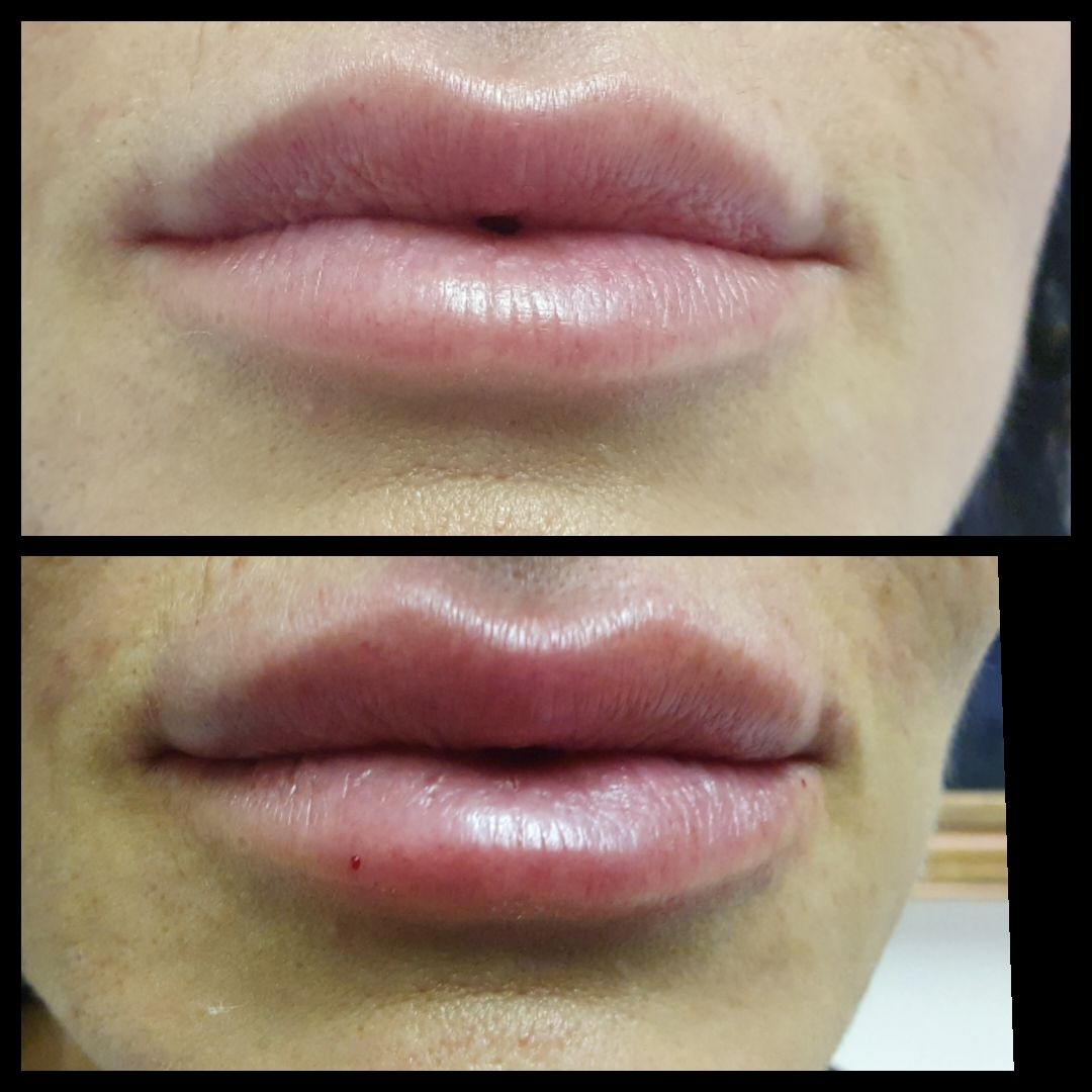 Andrea Menichelli-13