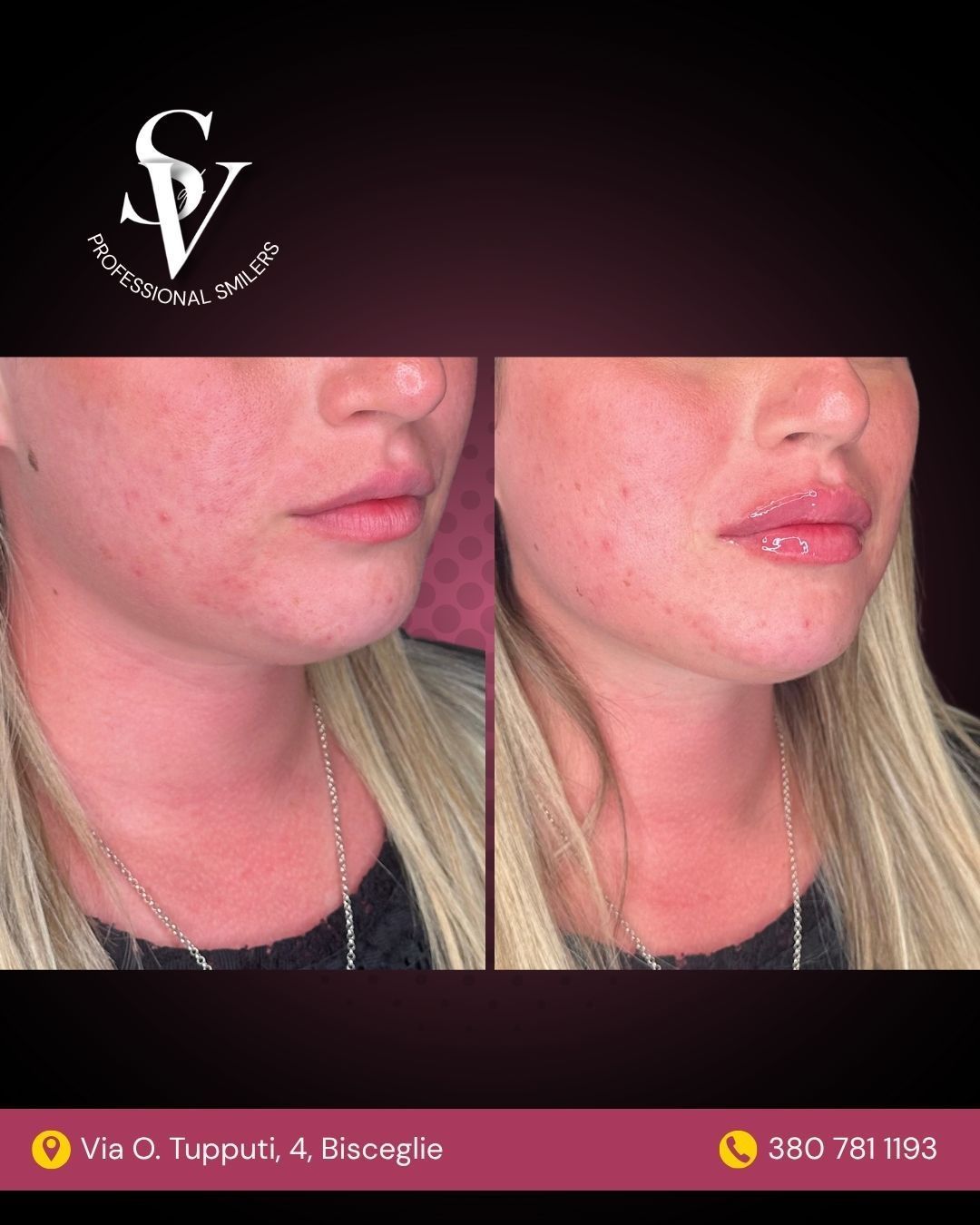 Silvia Squeo De Villagomez-1