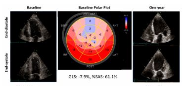 Giovanni Andrea Luisi-0