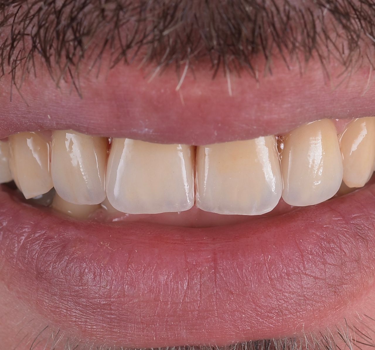 Riccardo Giardina-38