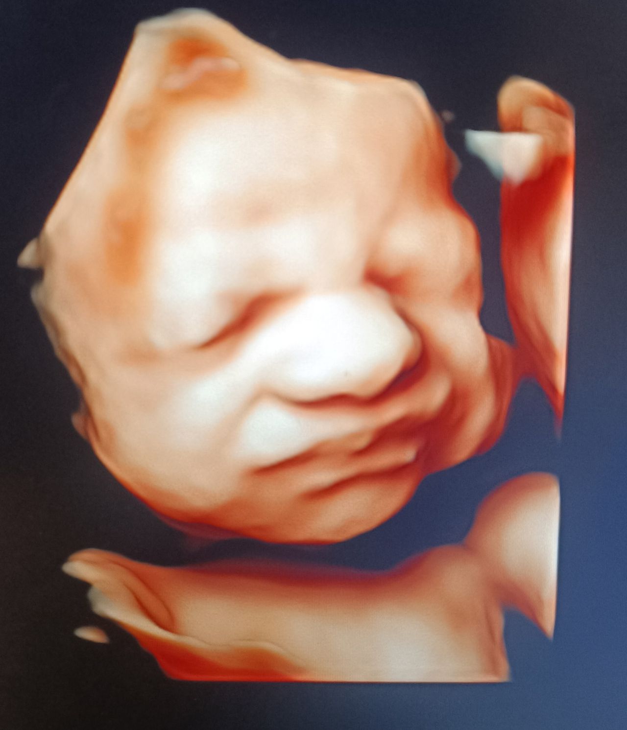 Nicoletta Vendola-13