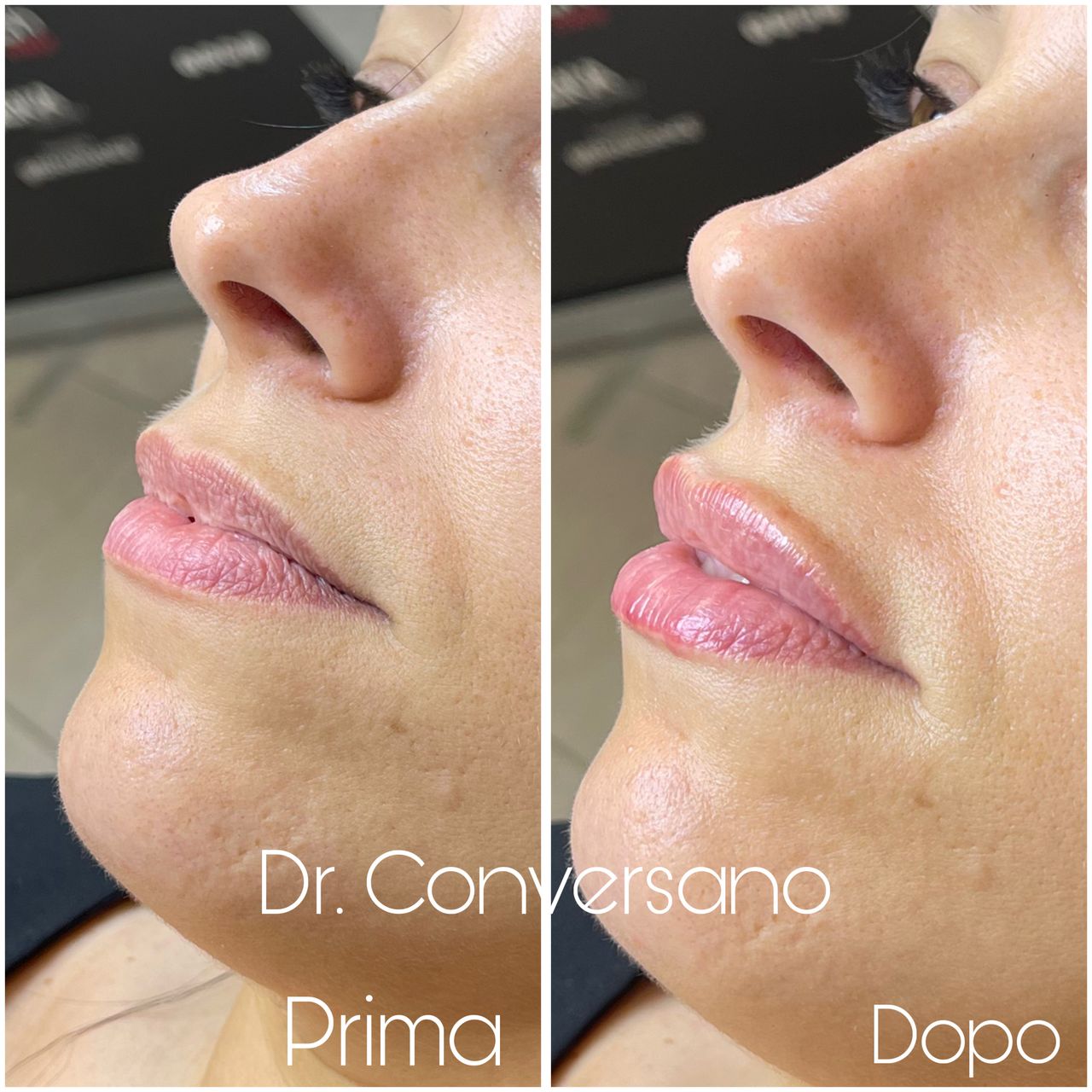 Sergio Conversano-26