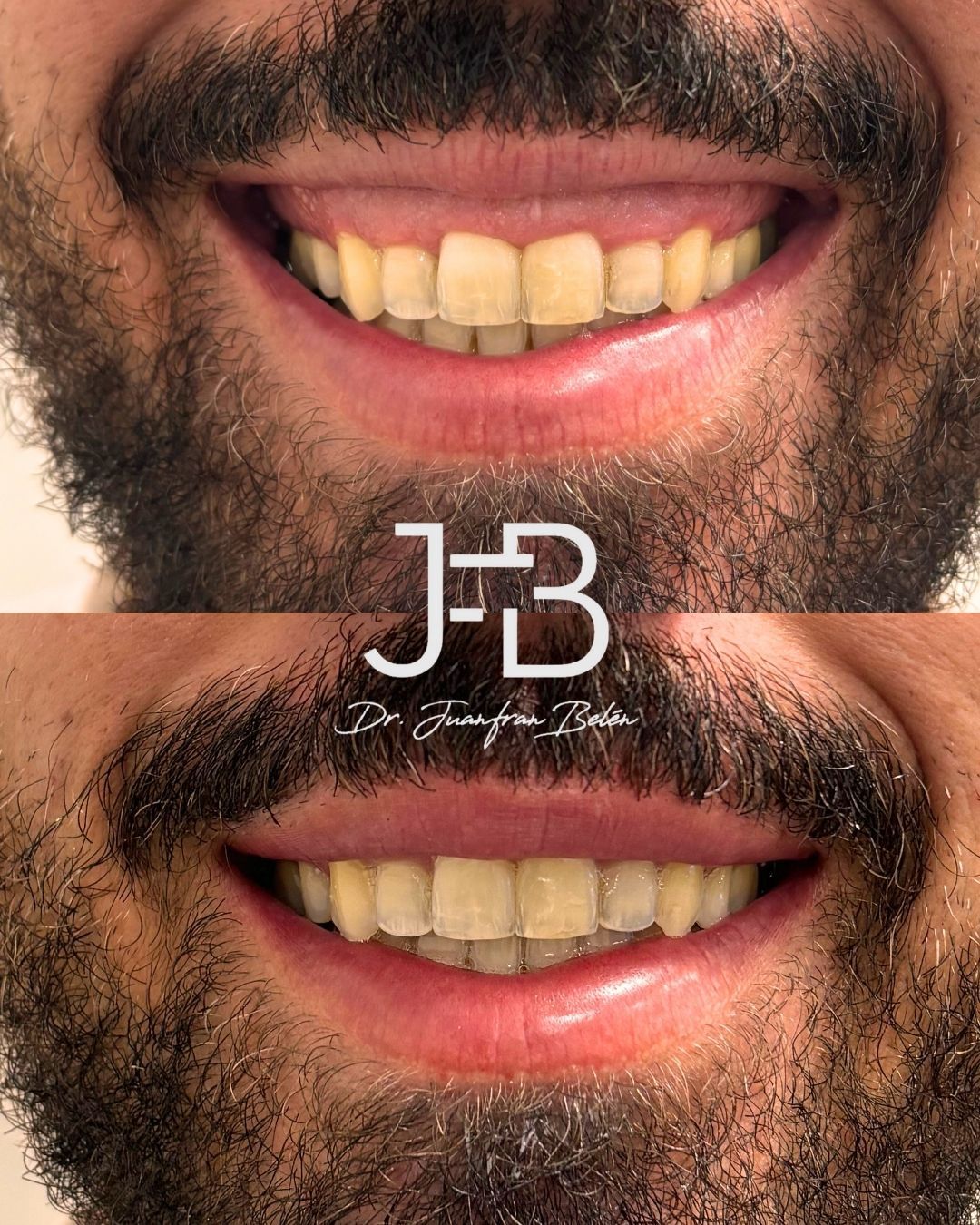 Juan Francisco Belén Montero-20