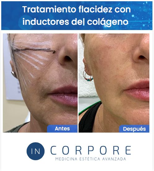 Juan Enrique Pérez Enríquez-141