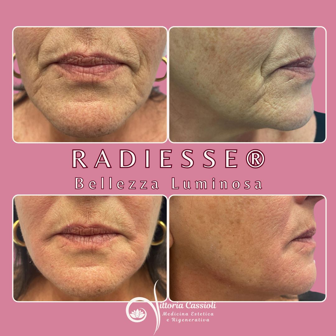 Vittoria Cassioli-40