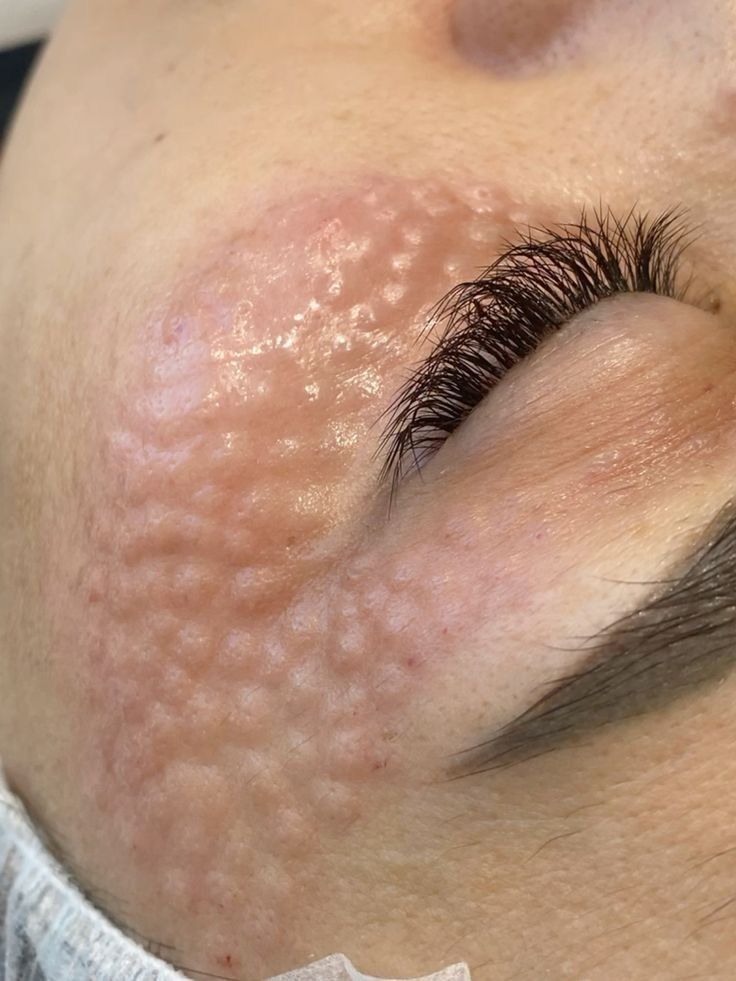 Yessica Corrales Acevedo-2