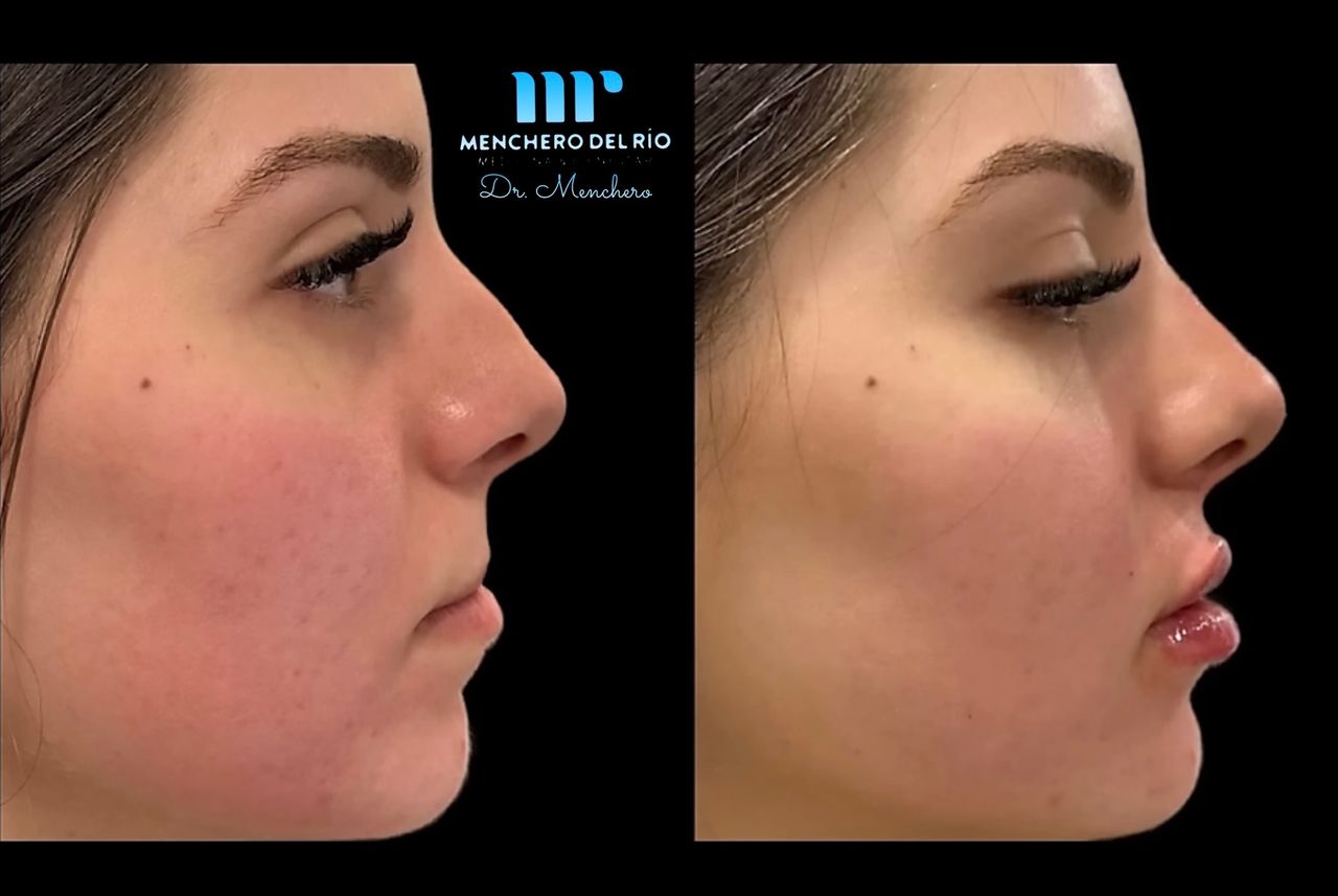 Arsenio Menchero Sánchez-25