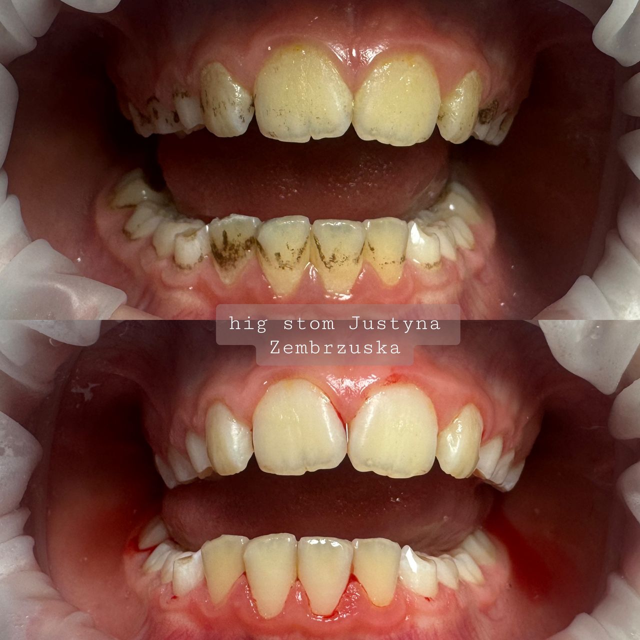 Justyna Zembrzuska-16