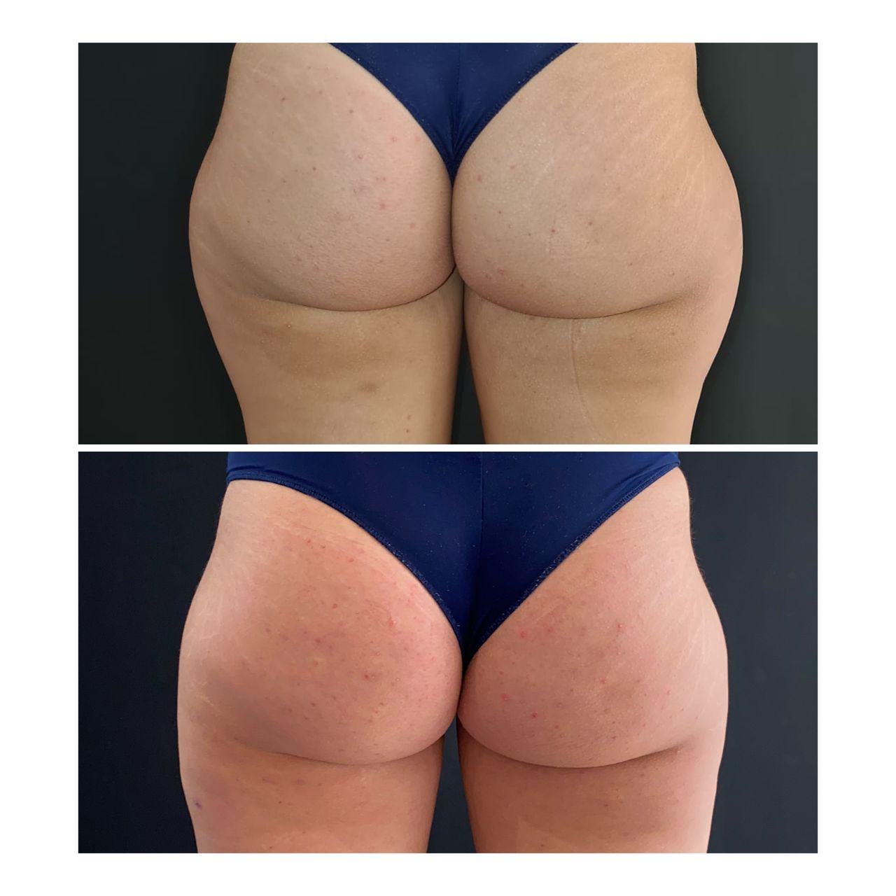 Maurizio Perugini-10