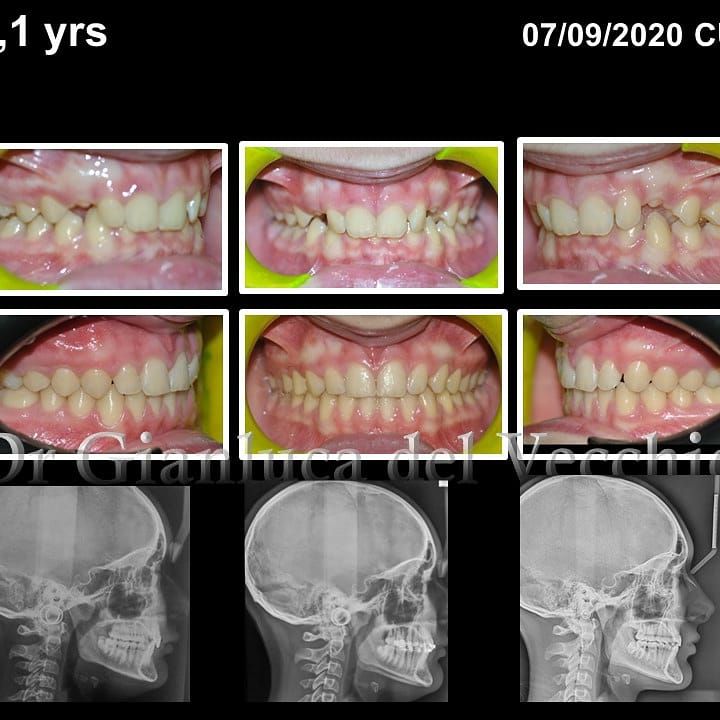 Gianluca Del Vecchio-51