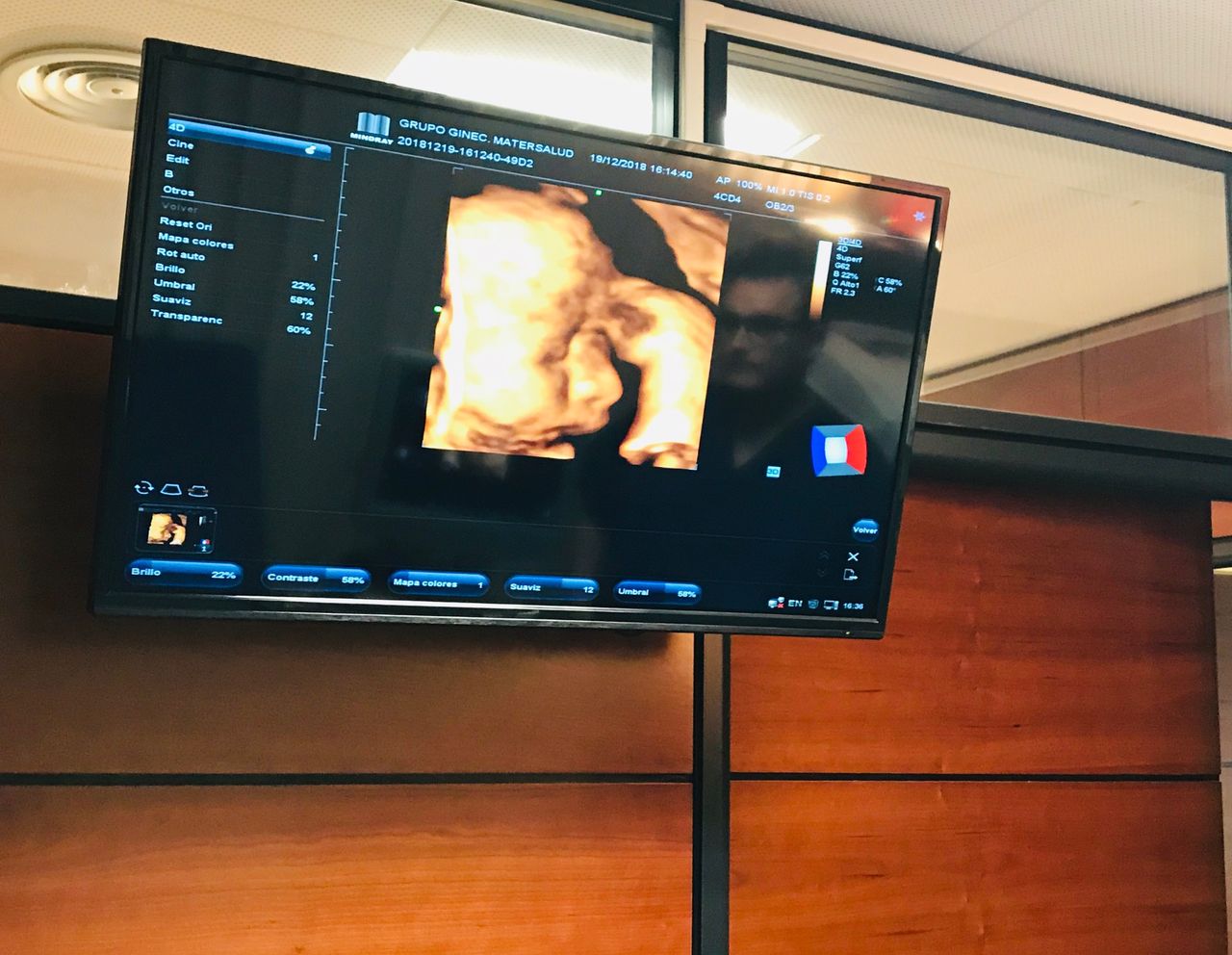 Aparicio Zanon Serrano-8