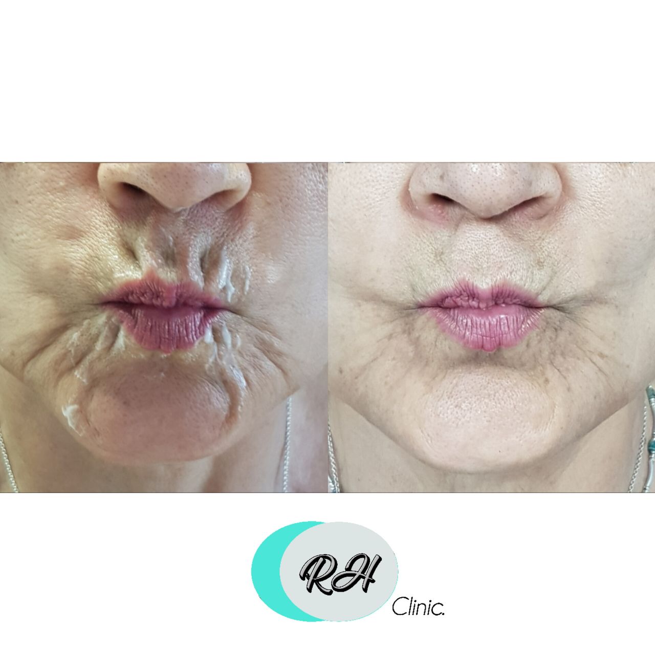 Rosalba Herrero Zerpa-90