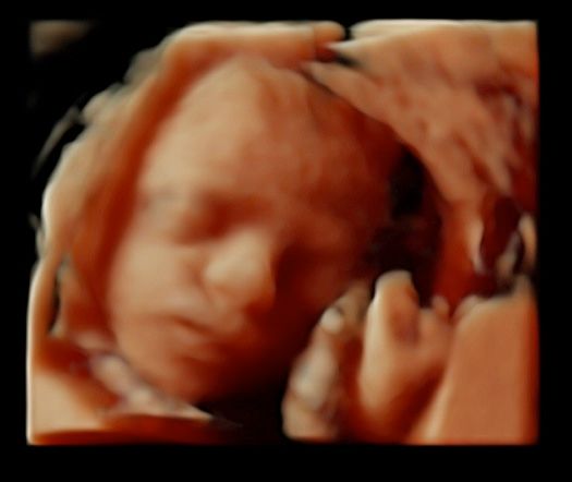 Tommaso Incandela-33