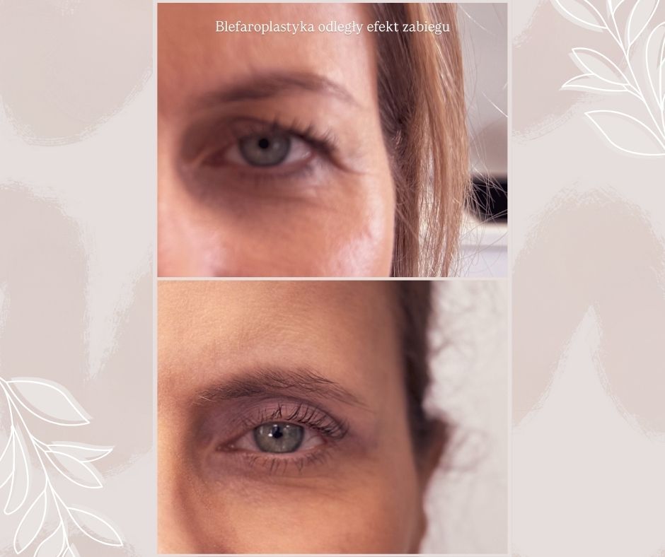 Piotr Florczuk-Dąbek-9