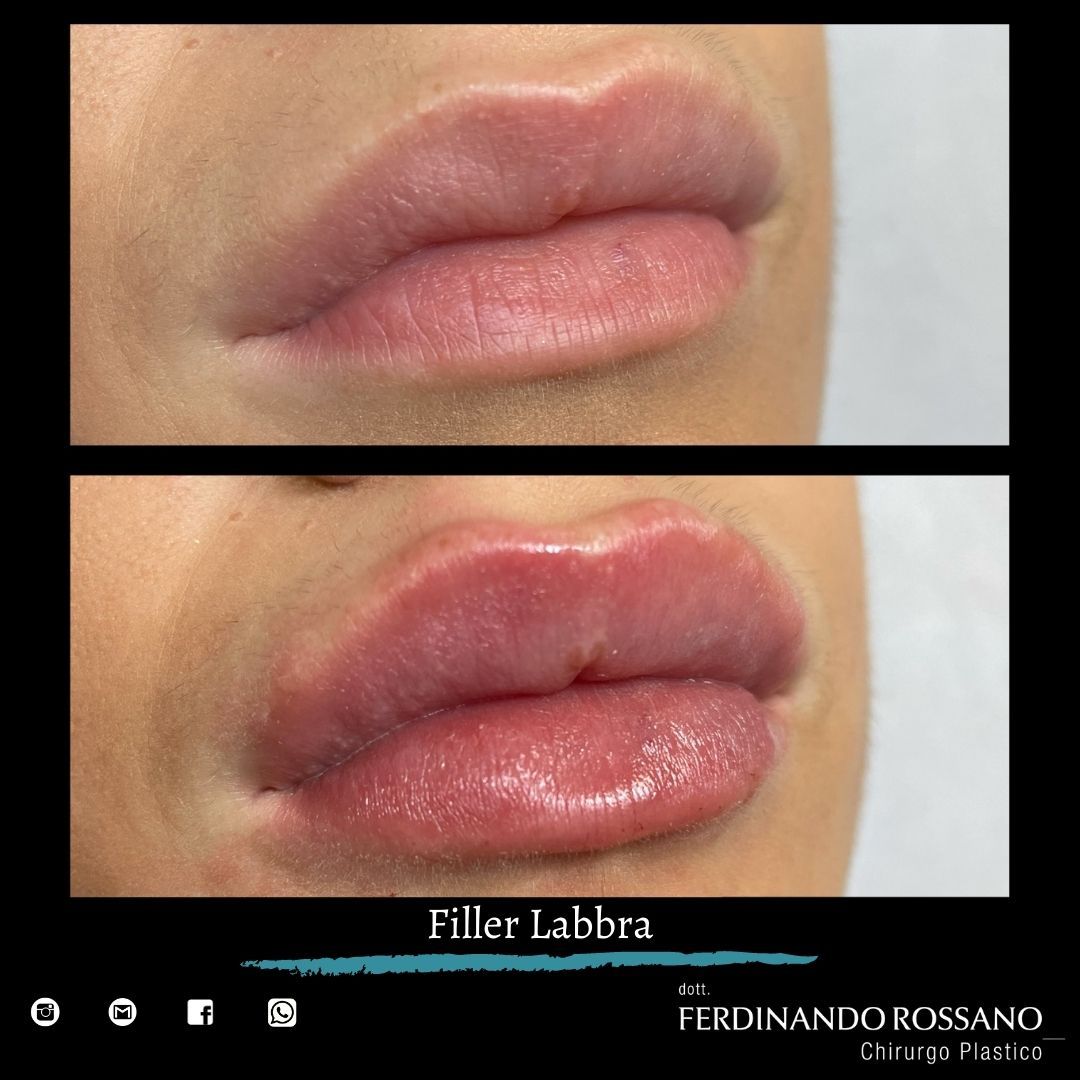 Ferdinando Rossano-4