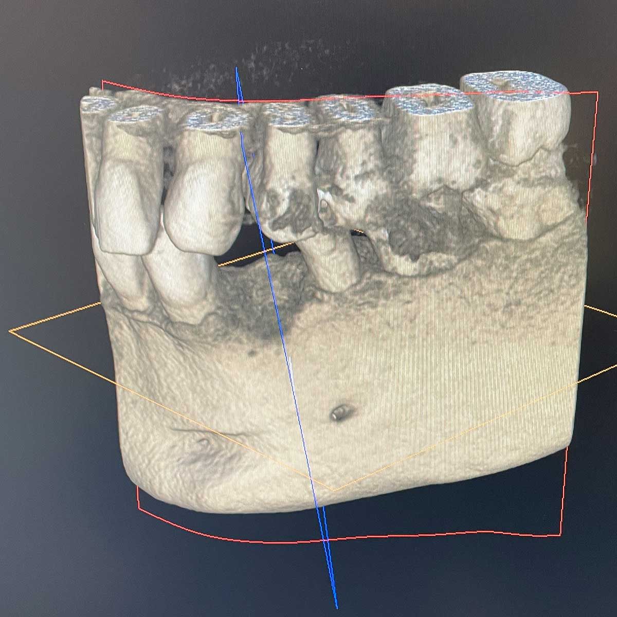 Gianluigi Bittante-79