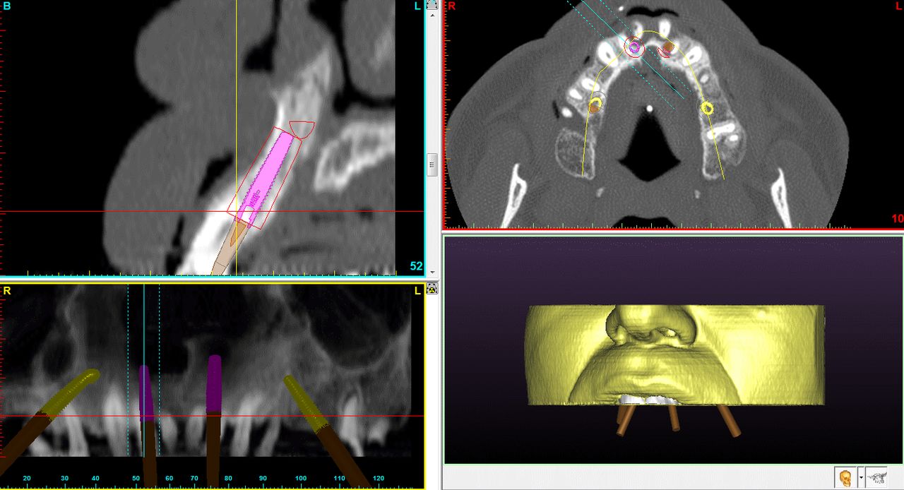 Alessandro Palumbo-10