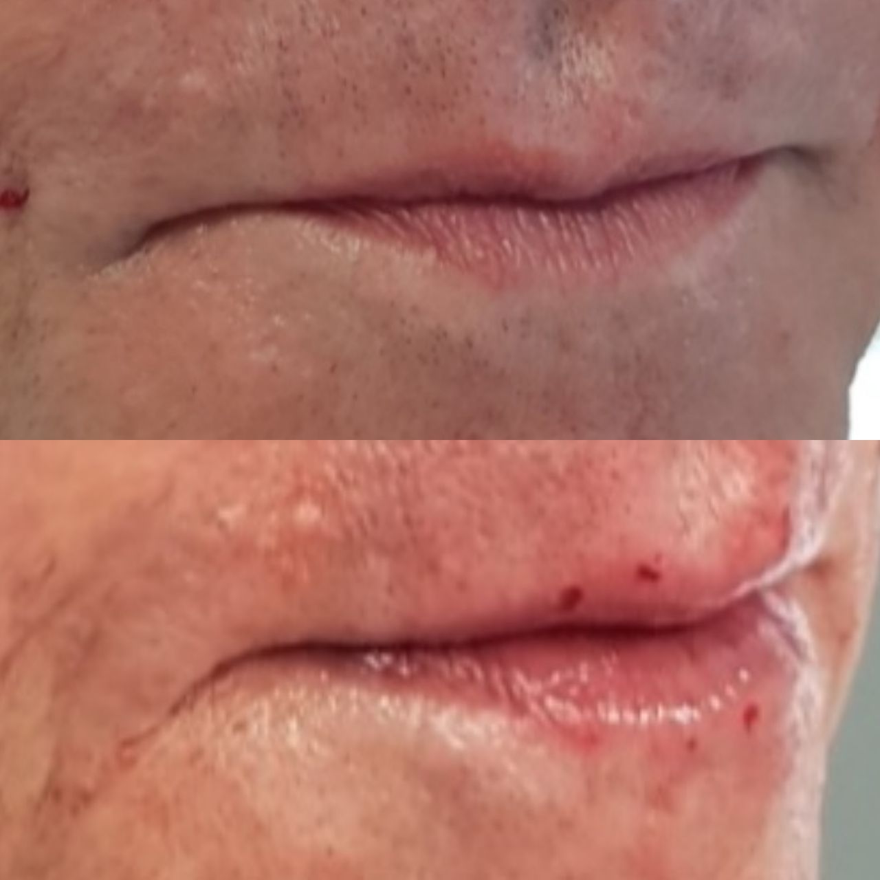 Rosalba Herrero Zerpa-462