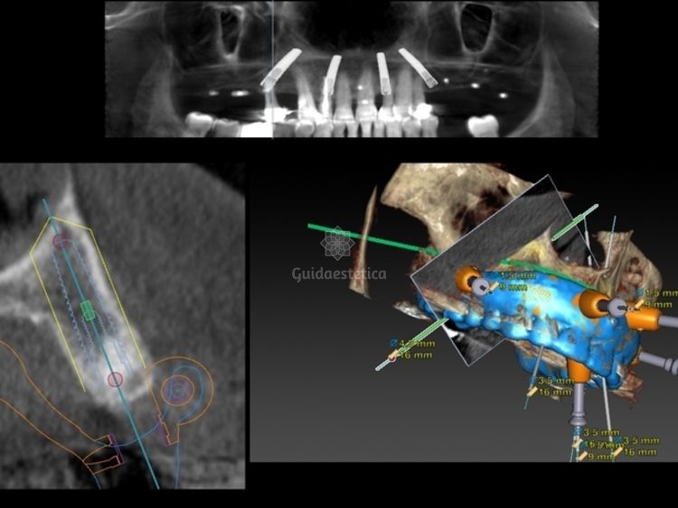 Alessandro Palumbo-59