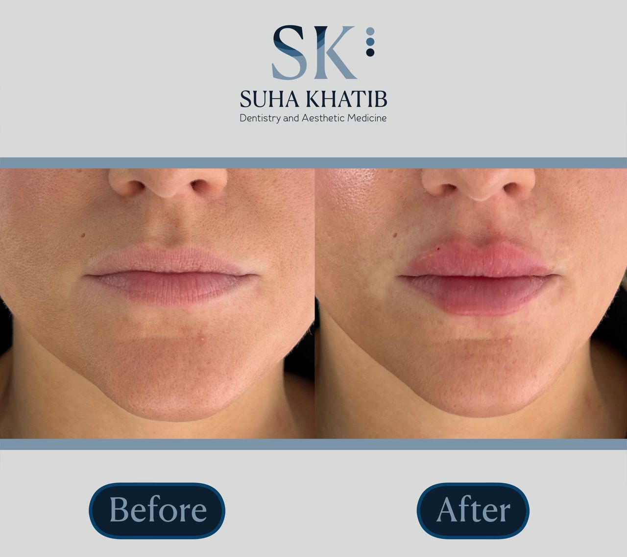 Suha Khatib-2